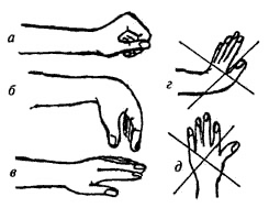 Фиксация кистей рук у шейников