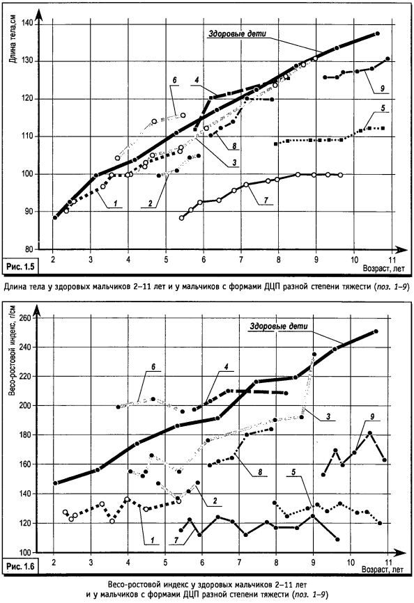 Возрастная динамика длины и массы тела у детей с НОДА в зависимости от тяжести основного заболевания