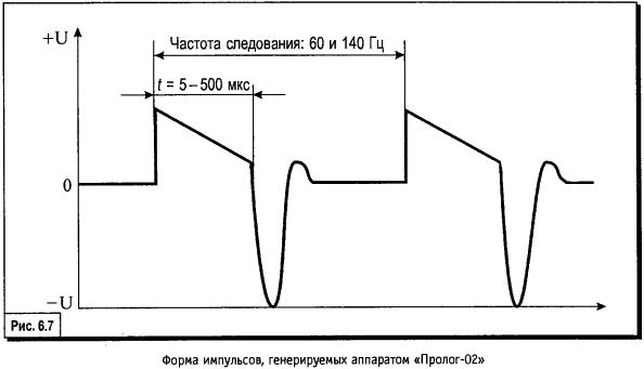 Терапия импульсными токами от аппарата «ПРОЛОГ-02»