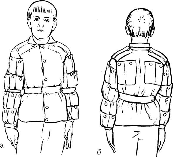 Больной в утяжеленной куртке: а — спереди, 6 — сзади
