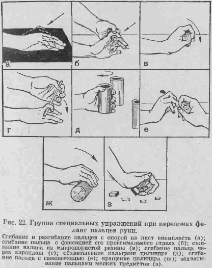 Специальные упражнения, применяемые после консолидации отломков фаланг пальцев