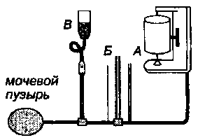 Схема аппарата для цистоманометрии