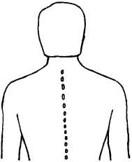 Состояние (положение) остистых отростков грудных позвонков до бокового наклона в исходном положении