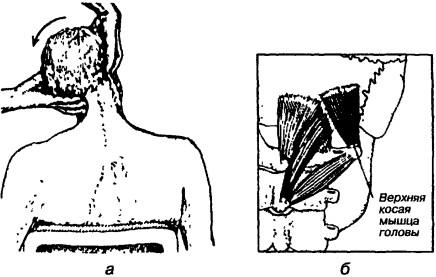 Проба на выявление укорочения мышц, участвующих в наклоне головы в атлантозатылочном суставе