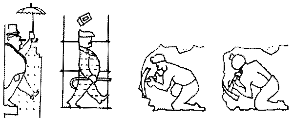 Механизм повреждений шейного отдела позвоночника (по A.G. Apley, 1982)