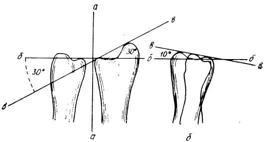 Схема соотношения дистальных концов лучевой и локтевой костей