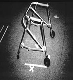 Ходунки с двумя колесиками позволяют легко передвигаться пациентам с нарушениями координации