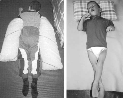 Использование такой подушки - одна из возможностей положить страдающего ребенка на живот