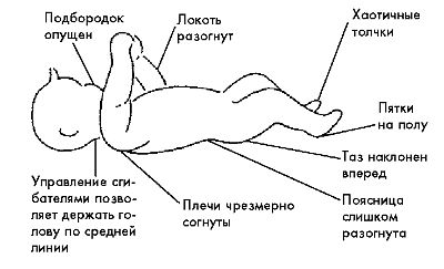 Контроль за положением тела в пространстве (постуральный контроль)
