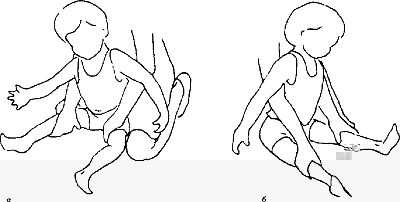 Когда вы сажаете ребенка с умеренно повышенным мышечным тонусом на пол с прямыми ногами