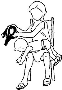 Удобное положение для одевания и раздевания младенца с сильной спастичностью в разгибателях