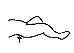 Сгибание таза (кзади) – ноги согнуты и приведены