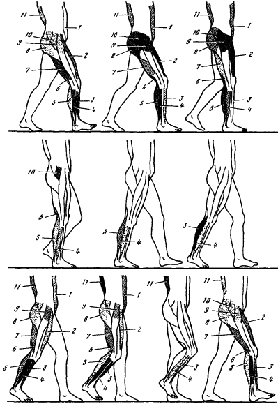 Степень сокращения мышц туловища и нижней конечности в течете двойного шага при обычной ходьбе