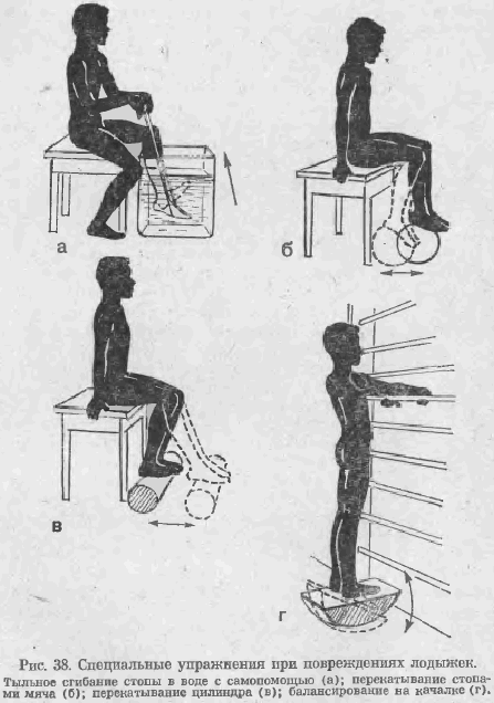 Методика применения физических упражнений при переломах лодыжек
