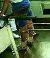 Обучение стоянию в коленоупоре с открытой калиткой при помощи резиновых тяг