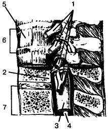 Схематическое изображение строения позвоночного столб