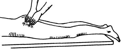 Пальпация грушевидной мышцы в положении больного лежа на животе