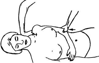 Мобилизация на плечевом суетаве в виде смещения головки плечевой кости в краниальном направлении