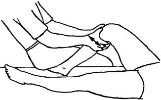 Мобилизация на коленном суставе в виде смещения большеберцовой кости