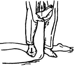 Дистракция коленного в положении больного лежа на животе