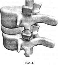Победить боль в спине: Мышцы, позвоночник