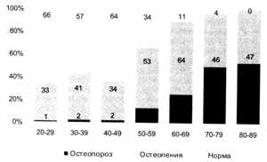 Частота остеопороза, остеопений в зависимости от возраста у женского населения Украины