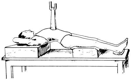 Наложение гипсового корсета в положении лежа с использованием аппарата Соколовского