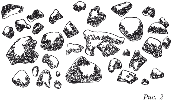 Камни в почках бывают различной формы