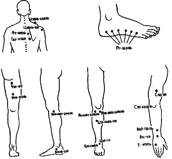Топография точек, рекомендуемых для стимуляции активных сокращений мышц плечевого и тазового пояса